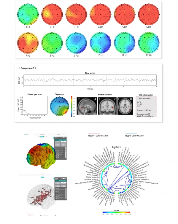 ‘아이싱크브레인-C’를 이용한 뇌파 시각화 데이터